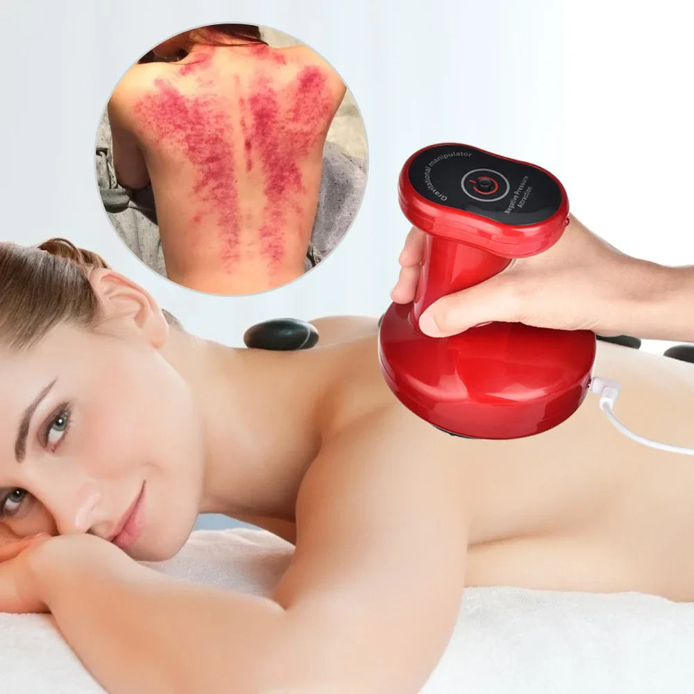 Electric Cupping Shaisu Cup Suction Massage