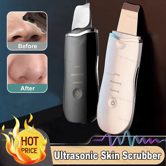 Ultrasonic Skin Scrubberskin Peeling Machine Blackhead Remove