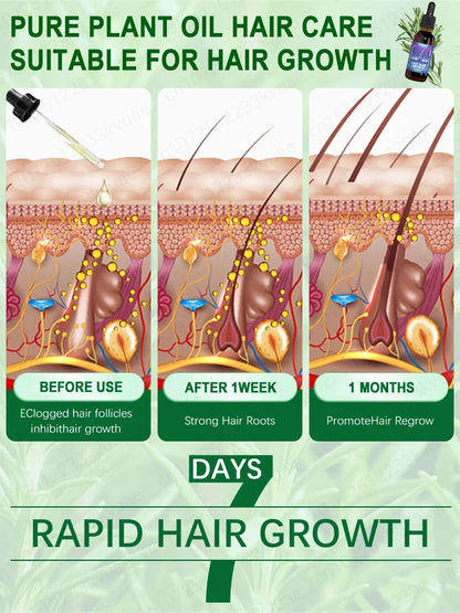 Hair growth essential oil, treatment for hair loss, baldness